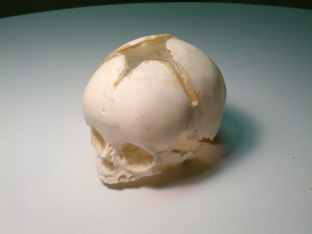 acoustic Neonatal skull phantom for radiography. Useful for X-Ray, CT, ultrasound, MRI and US