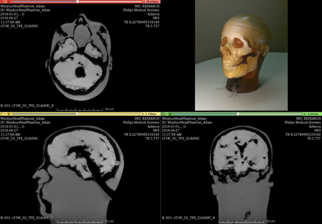 Head Phantom MRI result