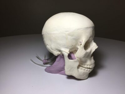 Skull with Brain