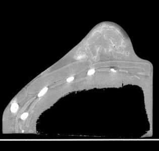 Adult female Breast Test Phantom CT, useful for mammogram testing