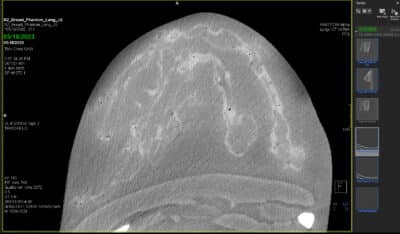 Breast Phantom X-Ray, useful for mammogram testing