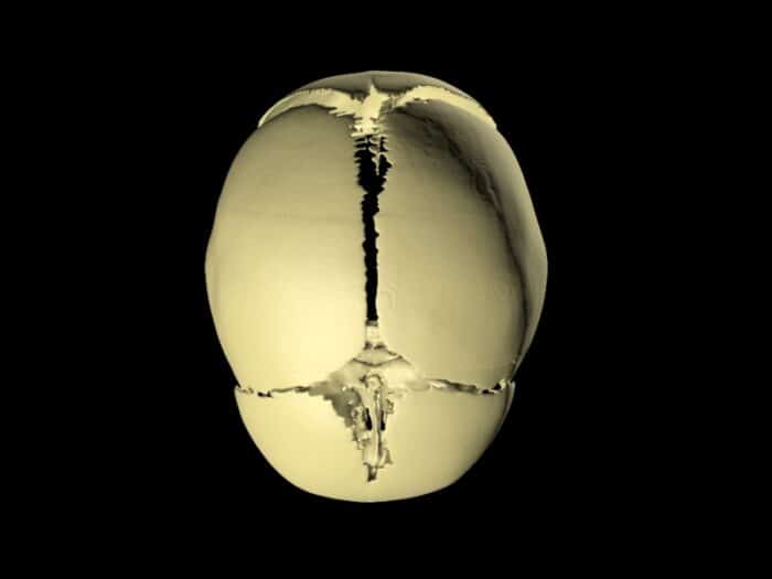 Newborn Skull for X-Ray CT, US, MRI - True Phantom Solutions