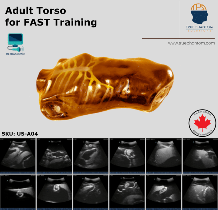 Adult Test Phantom FAST torso for training in FAST protocol using ultrasound US