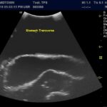 Advanced Torso Ultrasound scan