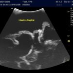 Advanced Torso Ultrasound scan