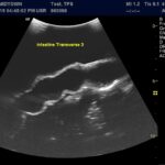 Advanced Torso Ultrasound scan