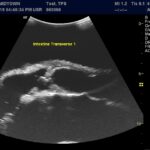 Advanced Torso Ultrasound scan