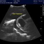 Advanced Torso Ultrasound scan