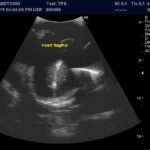 Advanced Torso Ultrasound scan