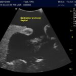 Advanced Torso Ultrasound scan