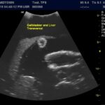 Advanced Torso Ultrasound scan