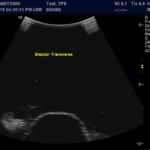 Advanced Torso Ultrasound scan