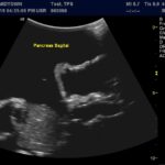 Advanced Torso Ultrasound scan