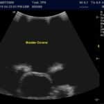 Advanced Torso Ultrasound scan