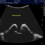 Advanced Torso Ultrasound scan