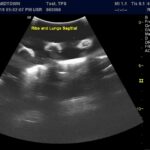 Advanced Torso Ultrasound scan