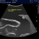 Advanced Torso Ultrasound scan