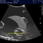 Advanced Torso Ultrasound scan