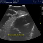 Advanced Torso Ultrasound scan