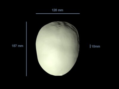 Calvaria Test Phantom for X-Ray, CT, US, Radiography, MRI, Ultrasound, US