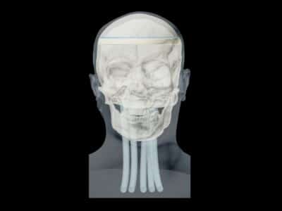 openable Head Phantom Design for Radiography Training