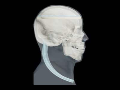 openable Head Phantom Design for X-Ray, CT, MRI, ND Ultrasound Training Tool