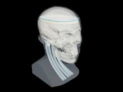 openable Head Phantom Design for X-Ray, CT, MRI, ND Ultrasound Training Tool