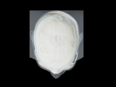 openable Head Phantom Design for Radiography Training