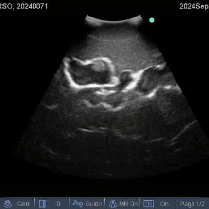 Ultrasound Scan for FAST Torso from TPS