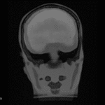 Head Scan MRI for FB-A02