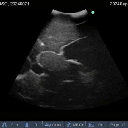 Ultrasound Scan for FAST Torso from TPS