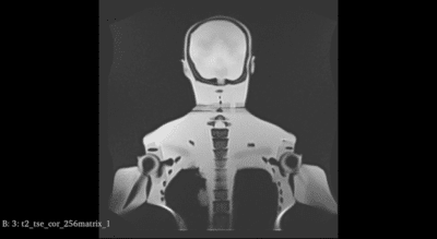 Head Scan MRI for FB-A02