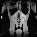 Torso Scan MRI for FB-A02