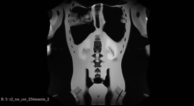 Torso Scan MRI for FB-A02