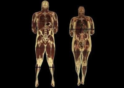 Visible Human Cross Section