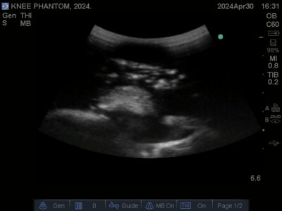 Ultrasound scan of Knee Phantom from True Phantom Solutions