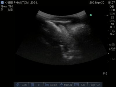 Ultrasound scan of Knee Phantom from True Phantom Solutions