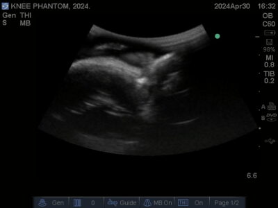 Ultrasound scan of Knee Phantom from True Phantom Solutions