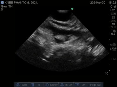 Ultrasound scan of Knee Phantom from True Phantom Solutions