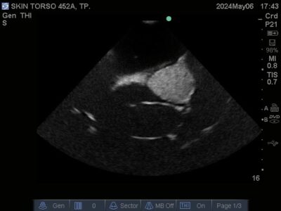 Ultrasound scan of Skin Torso Phantom from True Phantom Solutions