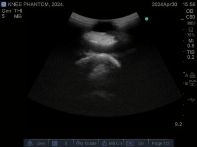 Ultrasound scan of Knee Phantom from True Phantom Solutions