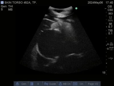 Ultrasound scan of Skin Torso Phantom from True Phantom Solutions