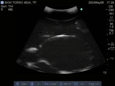 Ultrasound scan of Skin Torso Phantom from True Phantom Solutions